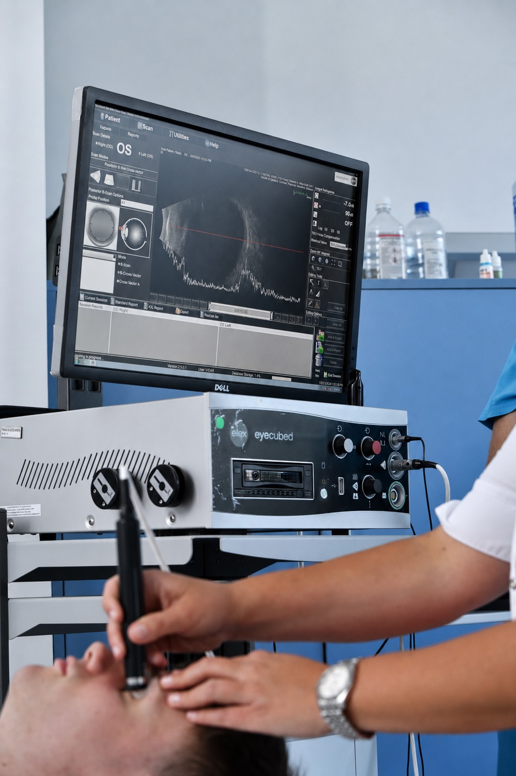 Ultrazvučni pregled oka (B-scan) u klinici VIDAR-ORASIS SWISS