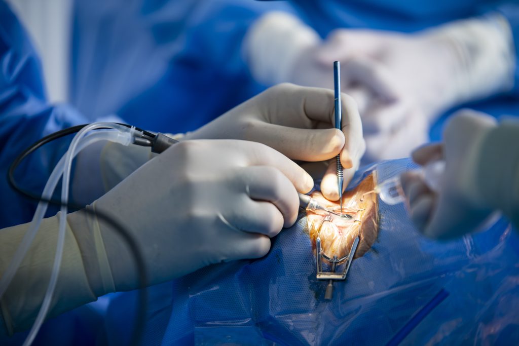 Mikrohirurška operacija oka pod operacionim mikroskopom